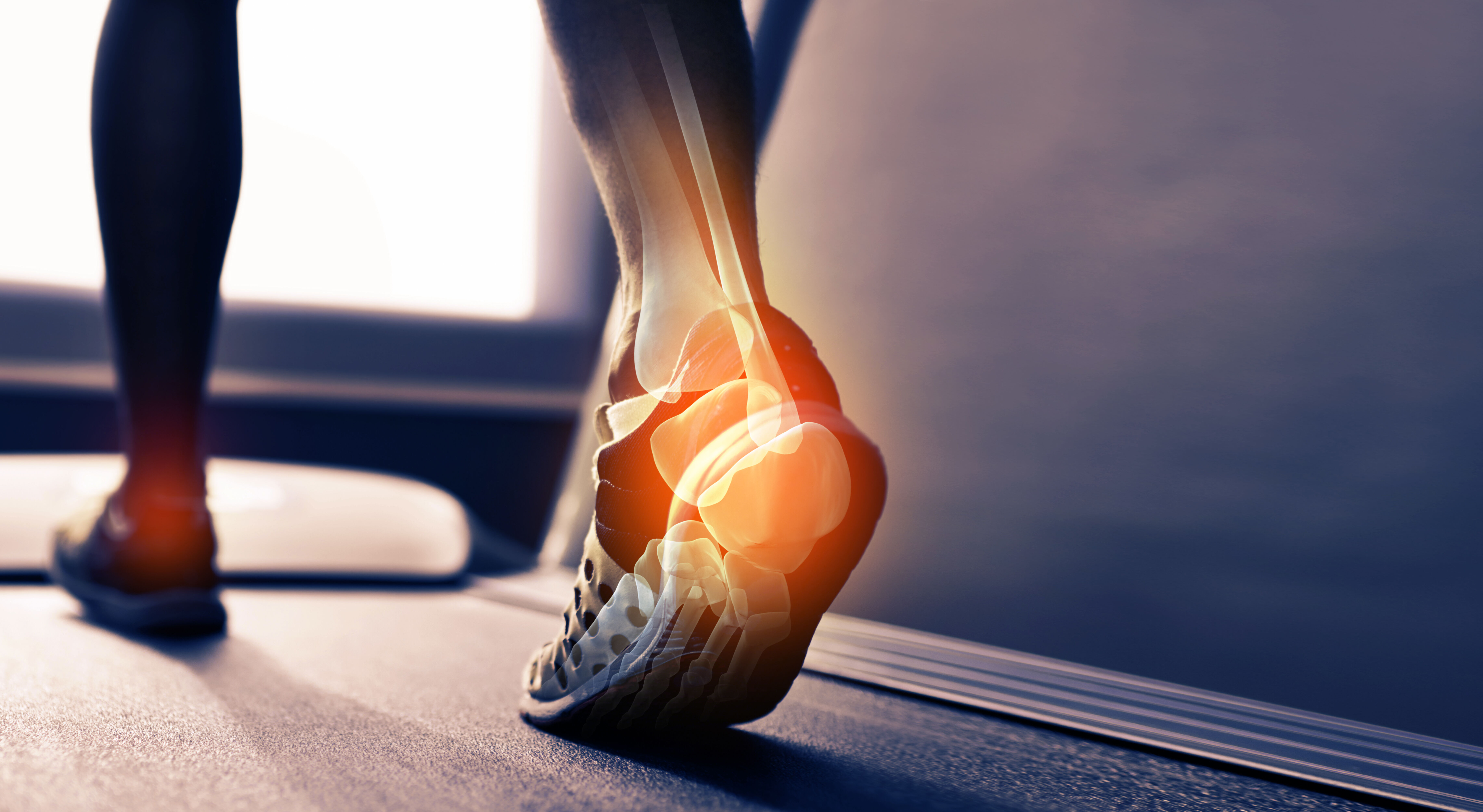 Läufer auf dem Laufband mit Knochendarstellung